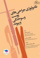 تکنولوژی جراحی های پوست و سوختگی و پیوند